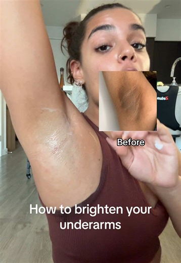 Kojic Acid and Turmeric for Brightening Dark Spots