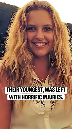 He Used An Axe To Do This... | Killer Bites