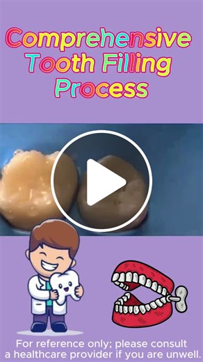 Step-by-step guide to a complete tooth filling process! From cleaning out decay to restoring your smile, here’s everything you need to know! #toothfilling #dentalcare #oralhealth #dentalfilling #toothrestoration #dental - NewsBreak