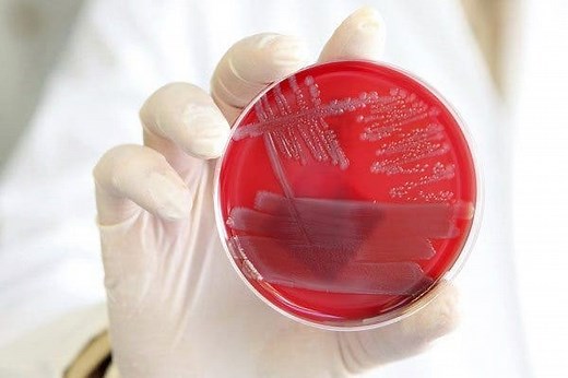 ¿Qué es la E. coli y cómo se contagia?