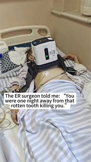 I thought it was just a bad tooth.I never imagined I would wake up surrounded by machines.#OralHealth #DentalHealth #Toothache #DentalInfection #SwellingGum #DentalProblems #ICU