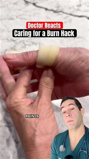 Doctor Reacts: how NOT to treat a burn