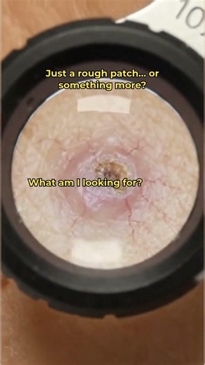 That rough, scaly spot you've been ignoring might deserve a closer look. 👀