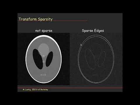 ISMRM MR Academy - Compressed Sensing in MRI