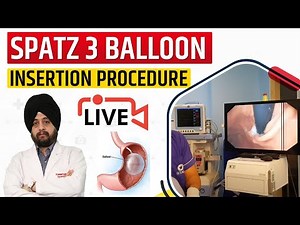 Spatz 3 Balloon Insertion Procedure ,Video, Overview, Unboxing, Implantation | Orb-era Balloon
