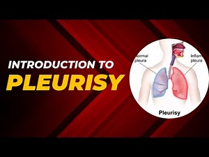 Introduction to Pleurisy: Types, Causes, Symptoms, Pathophysiology and its Management
