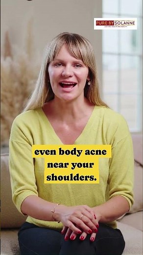Hairline Breakouts? This Might Be Why! | Skincare Tips You Need? #shorts