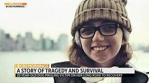 4.9M views · 251 reactions | One day before her 22nd birthday, Jacqueline Durand was attacked by two dogs she was dog-sitting. Her face was changed forever — but she survived. She says it is still her dream to work with animals, and she isn’t afraid of showing off her scars. | CBS Mornings | Facebook