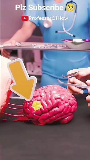 playing guitar during brain surgery (3D) by professor of how