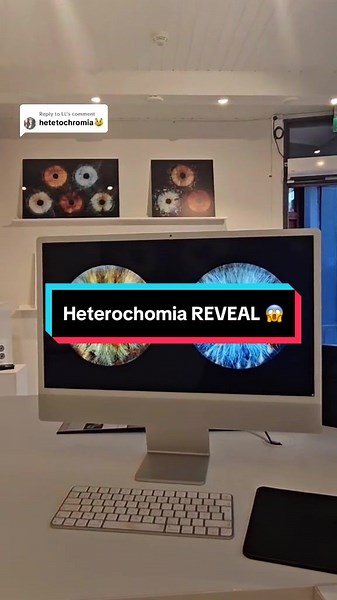 Heterochromia Revealed: Unique Eye Close-Up