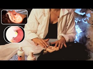 💤 Internal and external ear cleaning (visual examination with internal camera) - asmr orl
