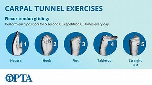 Doc Willie Ong FB Live: Paki-Share po. Makatutulong ito sa Bayan at sa inyo. Promise! Manhid at Masakit ang Kamay: Carpal Tunnel Syndrome Exercise para sa Kamay Video ni Doc Willie Ong 1. Alamin ang carpal tunnel syndrome. Ito’y nakukuha sa sobrang pagta-trabaho, paglalaba, pag-type at paggamit ng kamay. 2. Ipahinga ang kamay. Bawasan ang pagta-trabaho sa computer at pananahi. 3. Huwag i-bend ang kamay. Dapat ay derecho palagi ang wrist. 4. Panoorin ang mga exercise para sa Carpal Tunnel. Paki-L