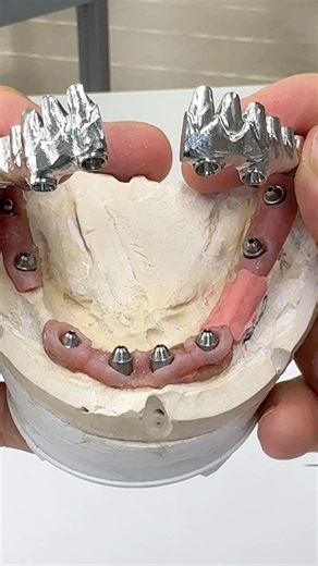 Welding techniques for Giant implants! | CEO Luke Kahng