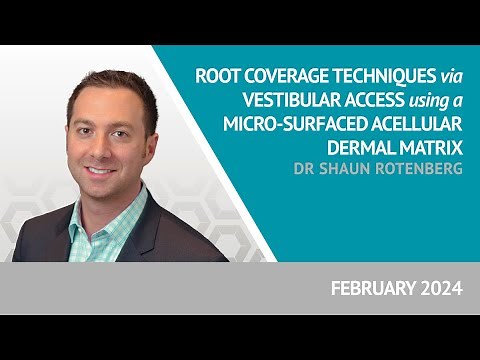 Root Coverage Techniques via Vestibular Access using a Micro-Surfaced Acellular Dermal Matrix - V1