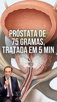 Reduced prostate size with steam.