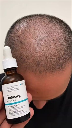 The ordinary Hair care multi-Peptide serum for hair density
