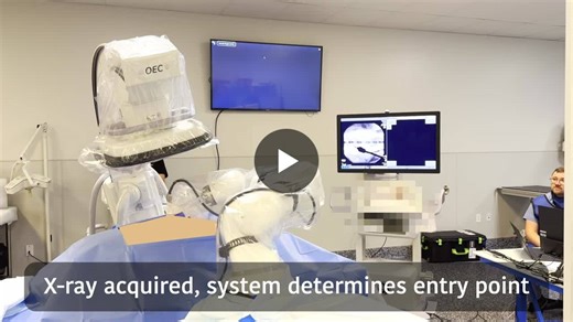 #robotics #navigation #spinalsurgery