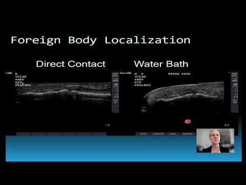 Ultrasound Cases in Emergency Medicine-Sample Excerpt