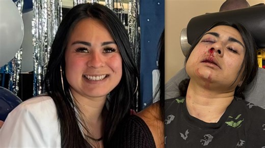 Woman recovering after violent attack at Daly City Nation’s