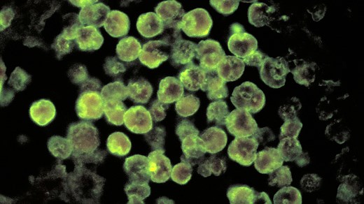 The truth about the brain-eating amoeba known as Naegleria Fowleri
