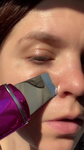 Jessica Simpson Ultrasonic Skin Scrubber: Whitehead Removal Tool