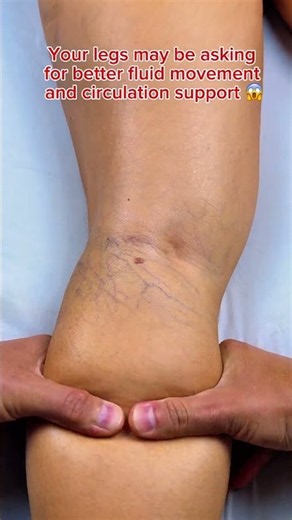 🦵 SPIDER VEINS? SWOLLEN LEGS? HEAVY, TIRED FEET? 👀