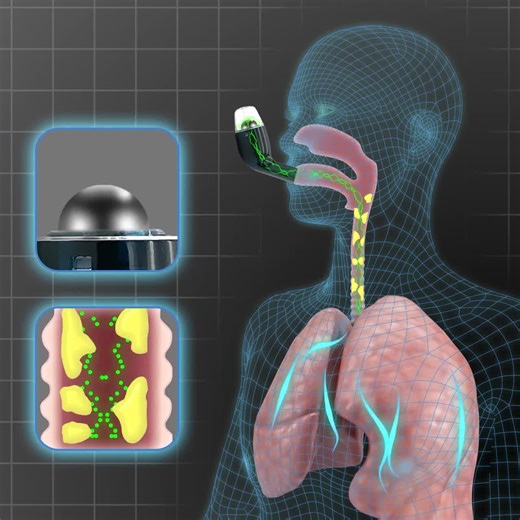 ⭐⭐⭐⭐⭐ "IT WORKS! (I too was skeptical). In March '19 I was diagnosed with chronic bronchitis/COPD. I researched and studied and came upon this device. I literally just opened this package and tried it twice and was brought to tears. My 1st 2 tries I was able to clear up mucus...without Albuterol or any steroids. I did it as directed for 10 minutes and started crying all again.. I was able to clear more mucus than when I'm on the nebulizer. At this moment I can inhale and exhale without coughing.