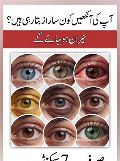 Eye Signs That Reveal Important Health Clues