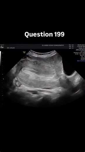 2.2K views · 398 reactions | Question 199: What is your diagnosis?...