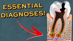Every Dental Diagnoses You NEED To Know When Seeing Patients! | Two Dentists