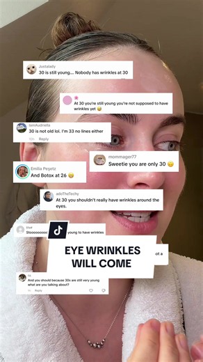 Eye Wrinkles at 30: My Experience & The Caroline Method