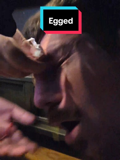 Aiden eggs Anthony after he found him in hide and seek #anthonyfrank #aiden #prank