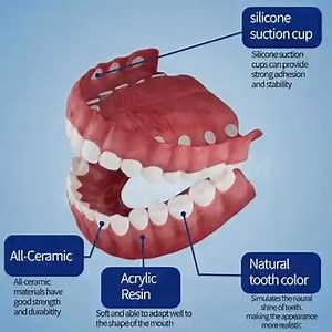 🌟 Enjoy unparalleled fit and all-day stability with the Biancat™ PerfectFit Denture Silicone Reline Kit! This revolutionary, soft silicone material conforms precisely to your mouth for personalized, lasting comfort. Safe, non-toxic, and easy to use, you can achieve a custom fit in minutes. 🛡️ Click to learn more and start your comfortable new life today! | Accessorize hub