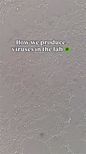 Tomasz Grzywa | From plasmid to engineered cells 🧬🦠 Step 1 - Cell seeding HEK293T cells are seeded the day before transfection to reach optimal... | Instagram