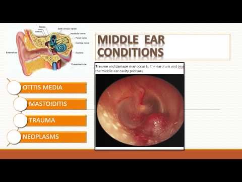 Care of Patients with Ear & Hearing Disorders