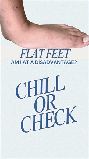 Flat Feet: Should You Chill Or Get It Checked? | Straits Podiatry Singapore