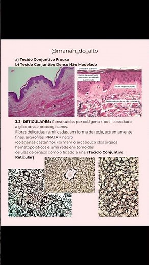 📚Tecido conjuntivo🩷 #histologia #estudantedemedicina #medicina #resumo #estudos