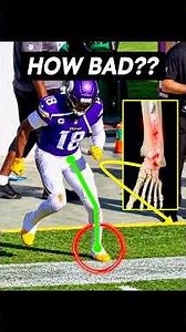 Justin Jefferson ANKLE injury—Doctor explains!