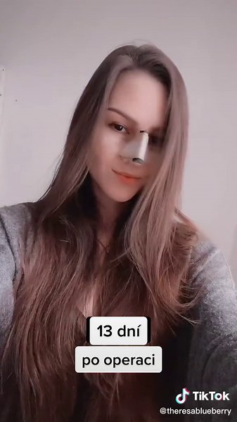 Plastic Surgery Transformation in Czech Republic