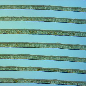 The dynamics of evaporative patterning