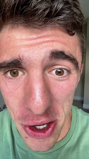 I HAVE TWO EYES AGAIN! | jarrett stod real eye