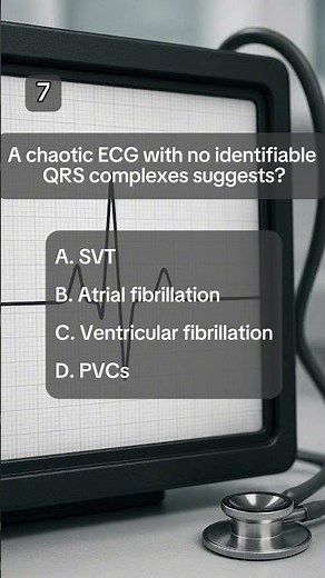 ECG Basics Explained | Anatomy Quiz: Cardiac Rhythms #quiz #quiztime