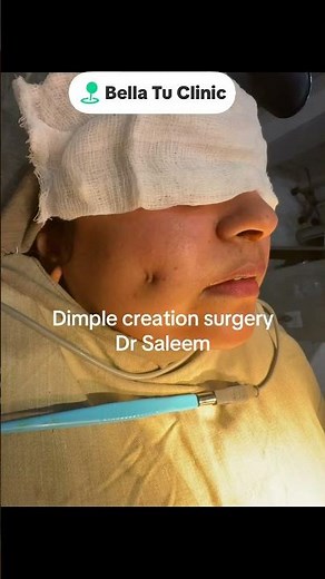 Dimple creation surgery before & after
