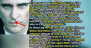 15 Famous Celebrity Scars Stories - Fact Republic