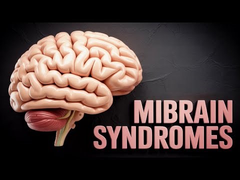 Localizing the Strokes - Part IV: Midbrain syndromes