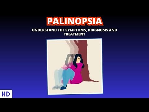 Palinopsia: Exploring the Phenomenon of Visual Afterimages