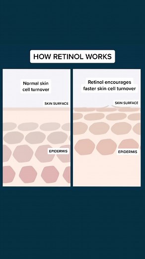 Understanding Retinol: How It Works and Benefits for Skin