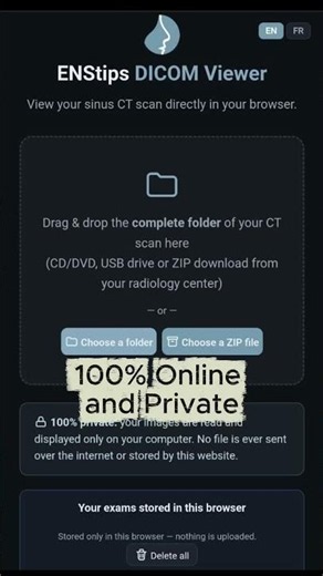 View Your Sinus CT Scan for FREE, 100% Private