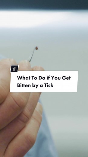 How to Properly Remove a Tick and Identify It