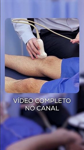 Ligamento Colateral Medial do Joelho. Veja aqui👆🏼 #comoeufaço